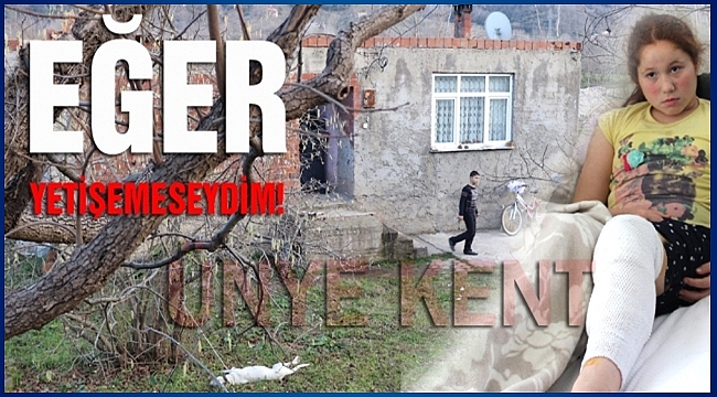 Az kalsın köpek küçük kızı parçalayacaktı