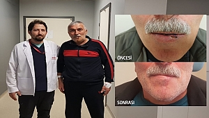 Uçuk sandığı dudak yarası kanser çıktı