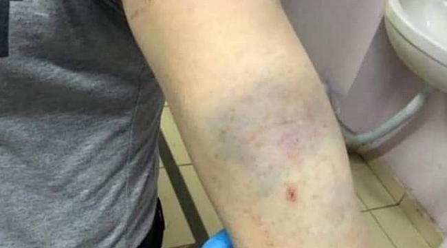 Doktor ve sağlık çalışanları darp edildi