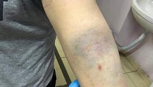 Doktor ve sağlık çalışanları darp edildi