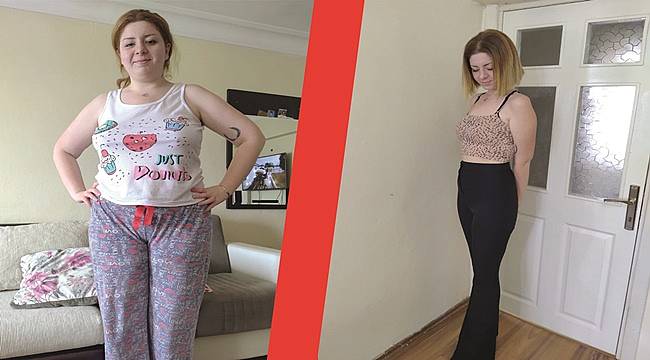 Mide ameliyatı oldu görenleri şaşkına uğrattı