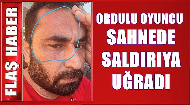 Ordulu oyuncu sahnede saldırıya uğradı
