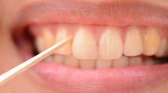 Kürdan ile diş temizliği doğru mu?