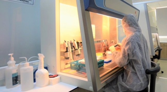 Türk bilim insanlarından Maymun Çiçeği için PCR Tanı Kiti!