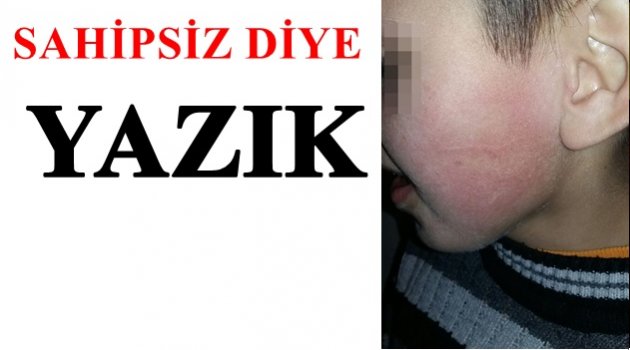 ENGELLİ ÇOCUKLARA ŞİDDET Mİ UYGULANIYOR?