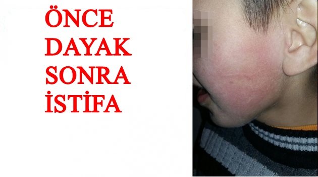 O MÜDÜR İSTİFA ETTİ