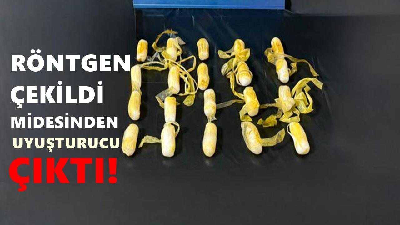 Ordu’da Midesinden 198 Gram Metamfetamin Çıktı